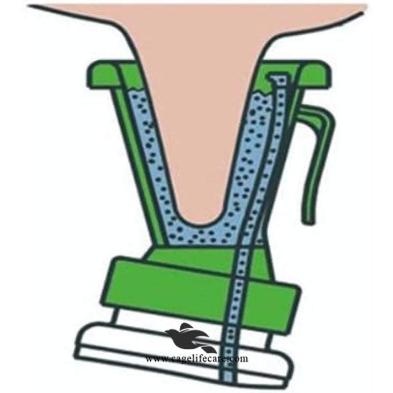 Teat Dip Cup – Hygienic Milking Accessory for Dairy Cattle & Buffaloes